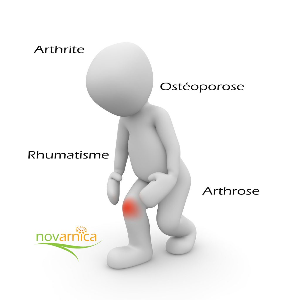 arthrite-osteo-rhumatisme-arthrose-nov-2016